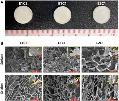 Nerve Decellularized Matrix Composite Scaffold With High Antibacterial Activity for Nerve Regeneration